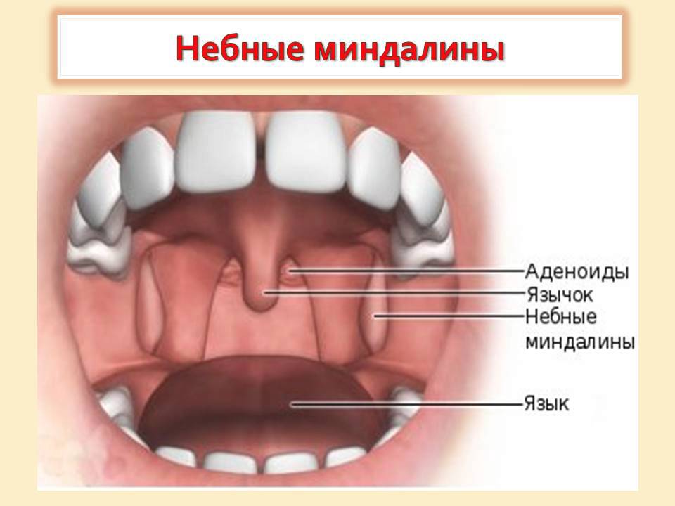 gnoynaya-angina-u-detey-3.jpg gnoynaya-angina-u-detey-3.jpg