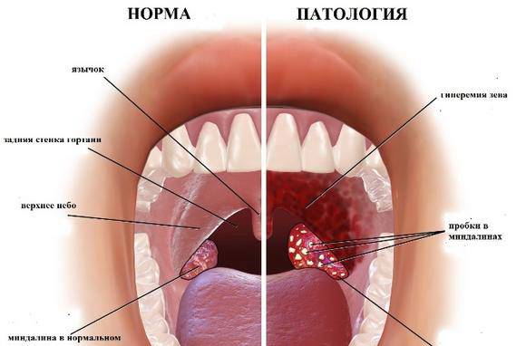 Белые Миндалины Фото