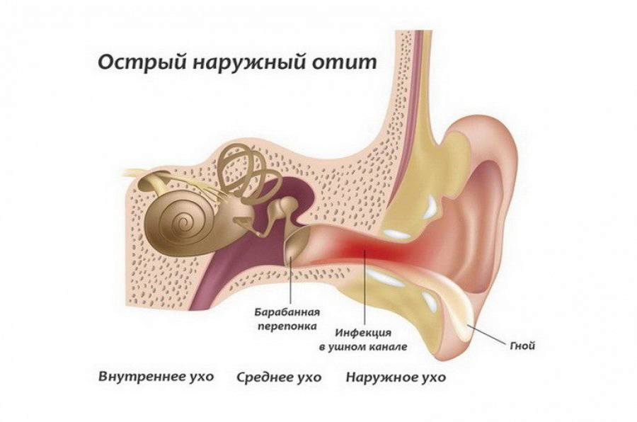 Как промыть уши в домашних условиях при отите thumbnail