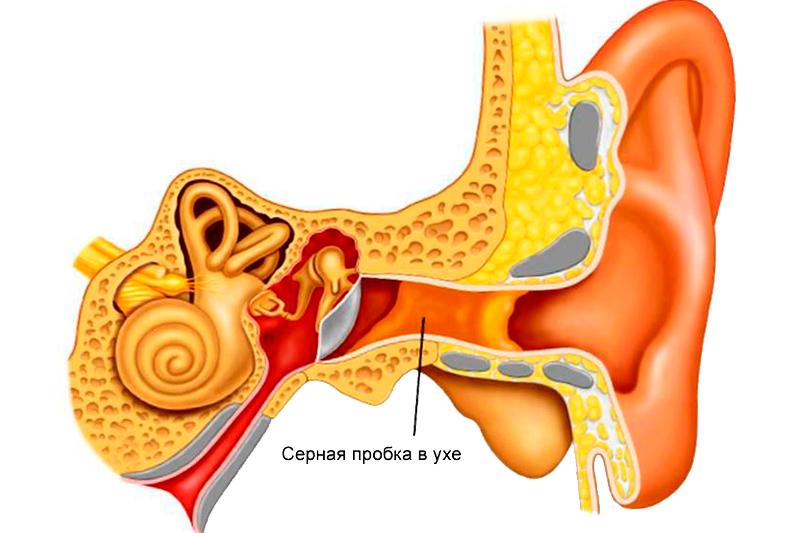 Удаление из уха серной пробки народными методами thumbnail
