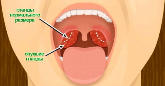 Как Выглядят Миндалины Фото
