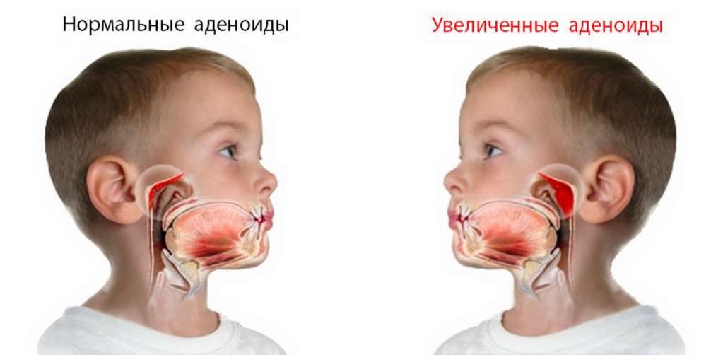 ад.jpg